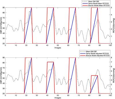 Breath-Hold Induced Cerebrovascular Reactivity Measurements Using Optimized Pseudocontinuous Arterial Spin Labeling